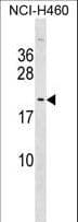 TTDN1 Antibody (aa151-177)