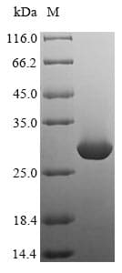 Rat Mast Cell Protease 2 [Mus musculus] Protein (Recombinant 6His, N-terminus + Myc, C-terminus)