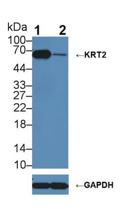 Polyclonal Rabbit anti-Rat KRT2 / CK2 / Cytokeratin 2 Antibody (aa368-507, WB)