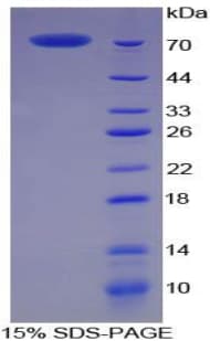 Pig CKM / Creatine Kinase MM Protein (Recombinant His-GST)