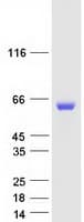 Human PPM1B Protein (Recombinant Myc-DDK (Flag))