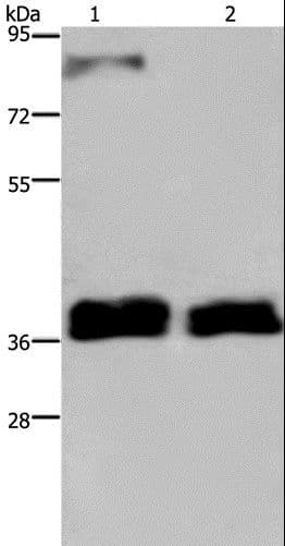 Polyclonal Rabbit anti-Human FETUB / Fetuin B Antibody (WB)