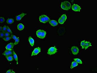 CEP83 / CCDC41 Antibody