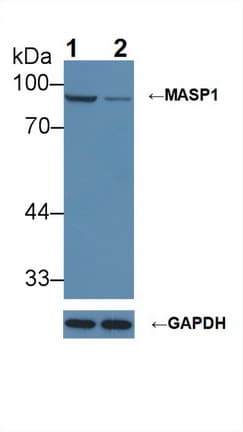 MASP1 / MASP Antibody (aa25-453)