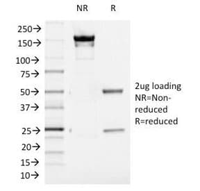 AURKB / Aurora-B Antibody (clone AURKB/1521)