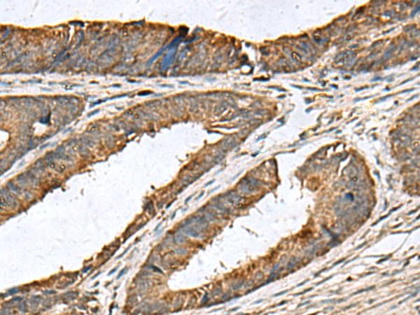 Polyclonal Rabbit anti-Human MRPL42 / MRPS32 Antibody (IHC, WB)