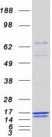 Human CARD16 / COP Protein (Recombinant Myc-DDK (Flag))