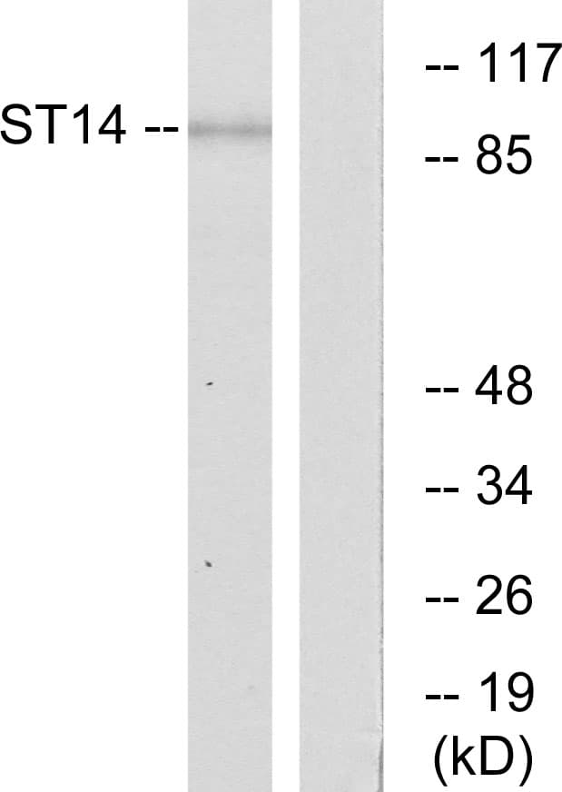 IHC-plus™ Polyclonal Rabbit anti-Human ST14 / Matriptase Antibody (aa10-59, IHC, IF, WB)