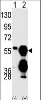 Polyclonal Rabbit anti-Human PPM1F Antibody (aa409-439, IHC, WB)