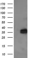 Monoclonal Mouse anti-Human KIF25 Antibody (clone OTI2D6, IHC, WB)