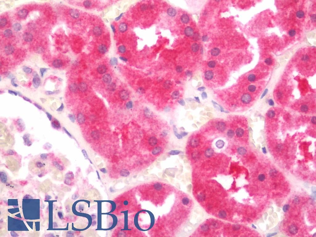 IHC-plus™ IQSEC1 Antibody