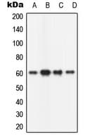 CAMK2B / CaMKII Beta Antibody (N-Terminus)