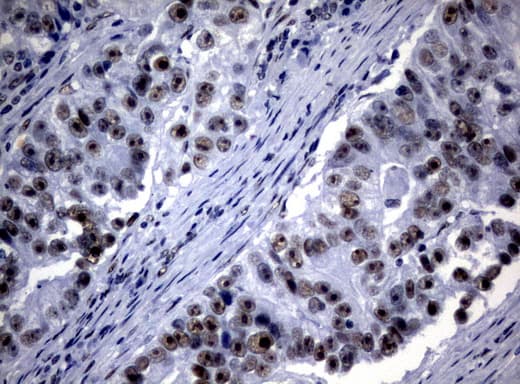 Monoclonal Mouse anti-Human NBN / Nibrin Antibody (clone UMAB100, aa183-460, IHC, IF, WB)