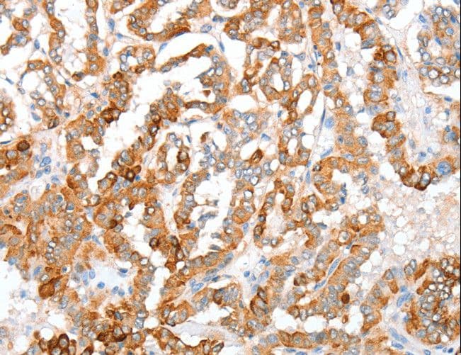 ACY3 Antibody