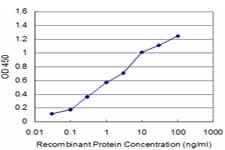 Monoclonal Mouse anti-Human PRKAR2A Antibody (clone 6A9, IHC, IF, WB)
