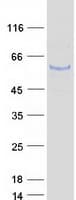Human TUBA1C / Tubulin Alpha 1C Protein (Recombinant Myc-DDK (Flag))