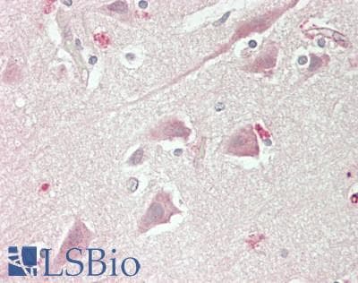 IHC-plus™ Polyclonal Rabbit anti-Human CACNA1E / Cav2.3 Antibody (Internal, IHC, WB)