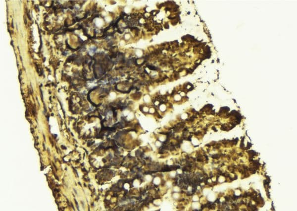 CHEK2 / CHK2 Antibody