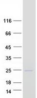 Human LACRT Protein (Recombinant Myc-DDK (Flag))