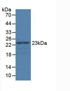 FBLN1 / Fibulin 1 Antibody