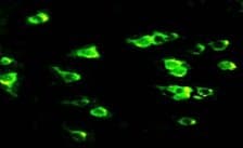 GRIN2B / NMDAR2B / NR2B Antibody (N-Terminus)