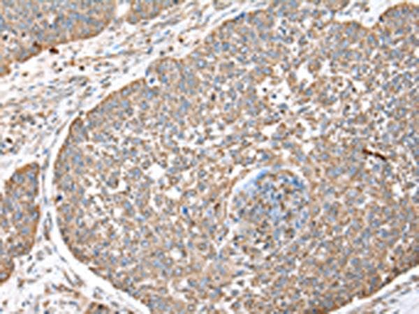 DPH7 / WDR85 Antibody