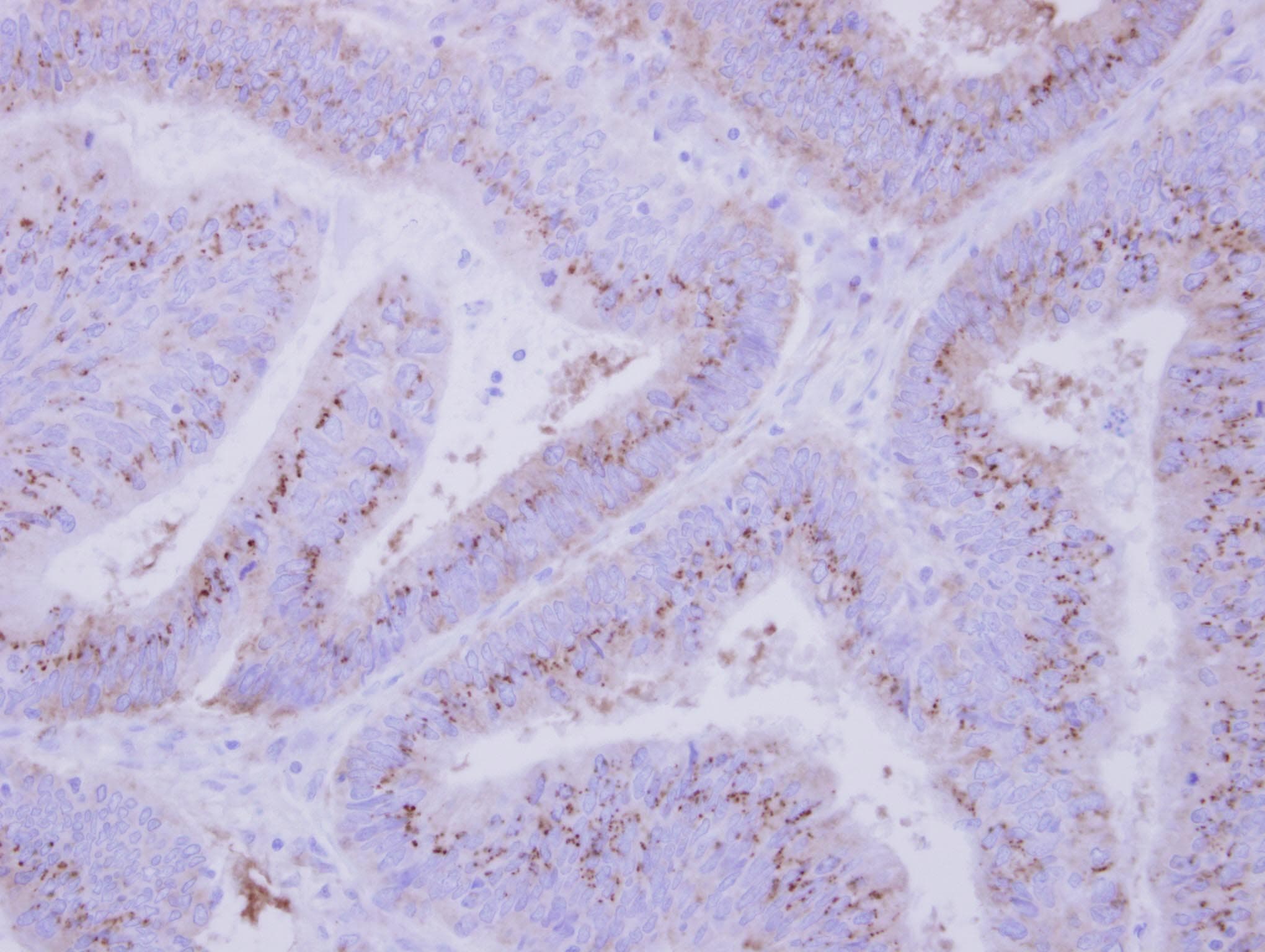 INPP5F Antibody (aa593-904)