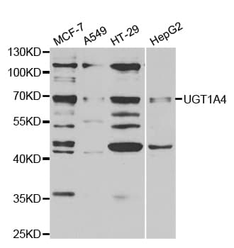 Polyclonal Rabbit anti-Human UGT1A4 Antibody (IHC, WB)