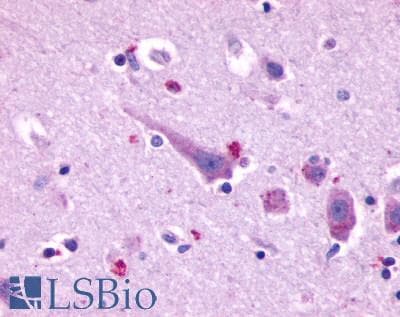 PathPlus™ PROKR2/Prokineticin Receptor 2 Antibody (C-Terminus)