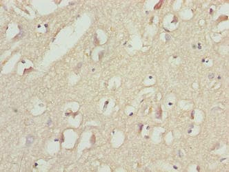MAP1LC3A / LC3A Antibody (aa1-120)