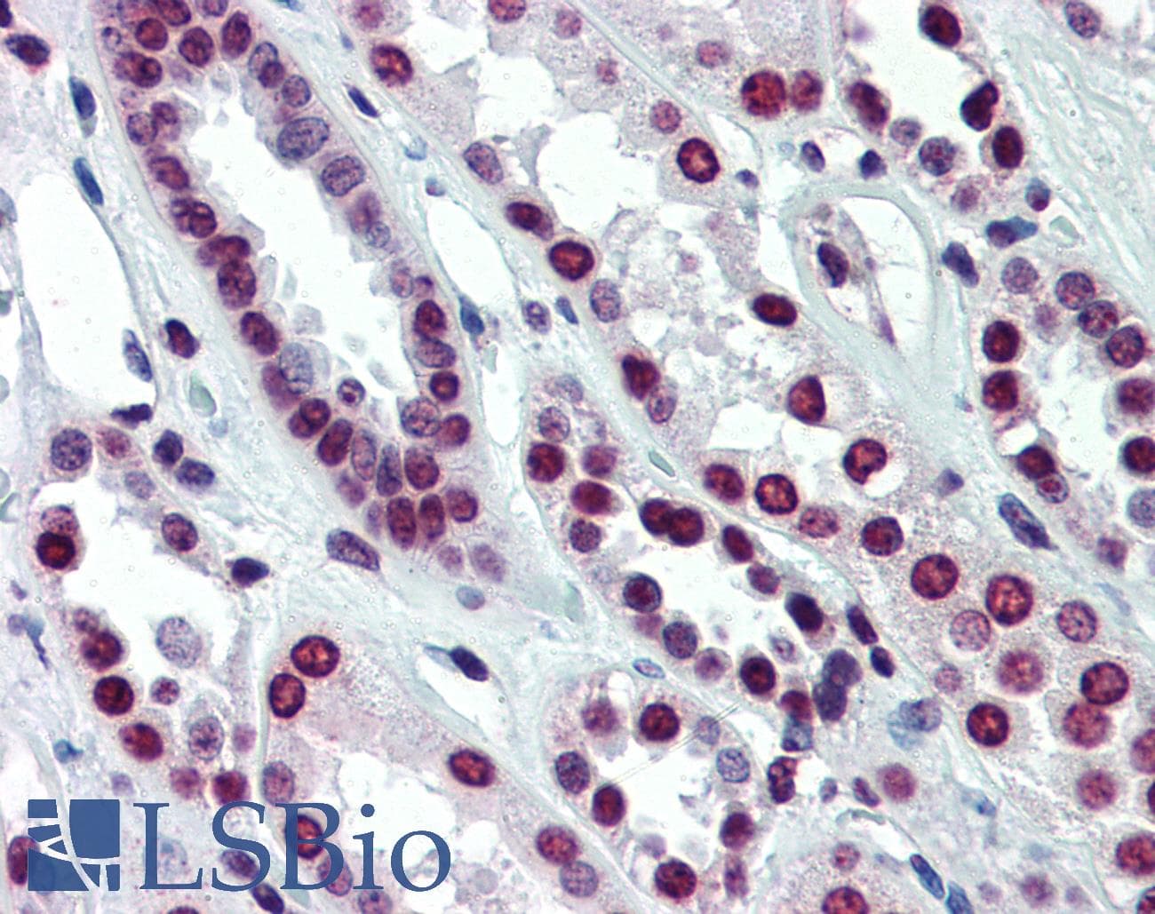 Polyclonal Rabbit anti-Human ARID5A Antibody (C-Terminus, IHC, WB)
