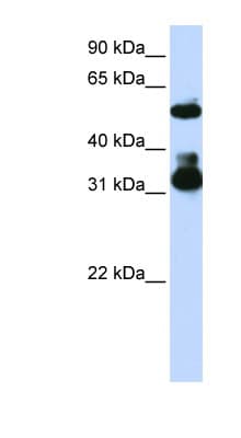 FBXW2 Antibody (C-Terminus)