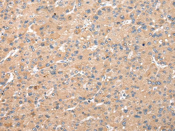 WDR18 Antibody