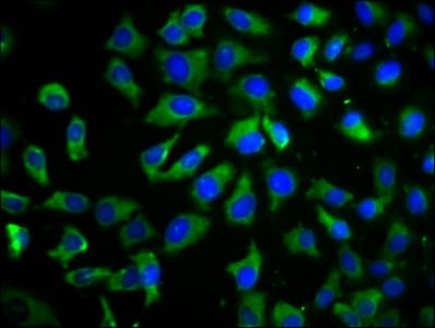 Polyclonal Rabbit anti-Human TMEM26 Antibody (IF)
