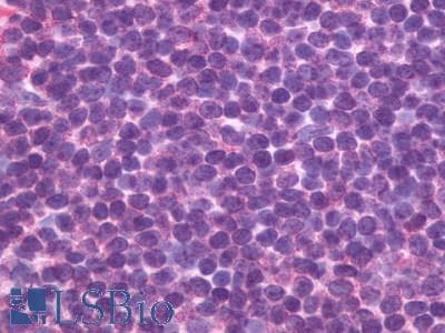 IHC-plus™ CXCR5 Antibody (Cytoplasmic Domain)