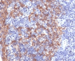 KRT14 / CK14 / Cytokeratin 14 Antibody (C-Terminus, clone LL002, Azide-free, BSA-free)