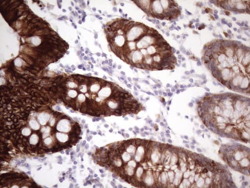 KRT16 / CK16 / Cytokeratin 16 Antibody (clone 7A4, Carrier-free)