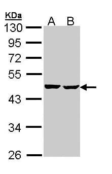 Polyclonal Rabbit anti-Human SUCLA2 Antibody (aa138-416, IHC, WB)