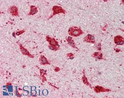 IHC-plus™ HSP90B1 / GP96 / GRP94 Antibody (aa754-803)