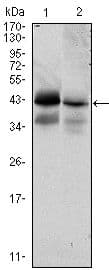 EPCAM Antibody (clone 7E+11)