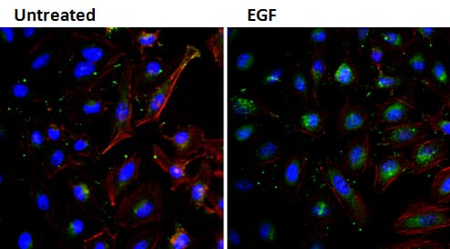EGF Antibody (clone 3A8, Biotin)