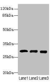 CELA3A / ELA3 Antibody (aa29-270)