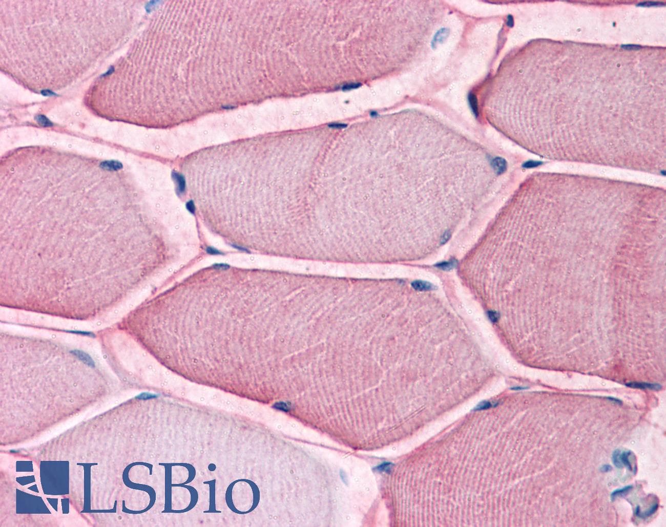 IHC-plus™ SLC1A5 / ASCT2 Antibody (Internal)
