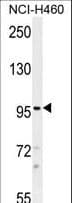 Polyclonal Rabbit anti-Human TRPM8 Antibody (aa69-98, IHC, WB)