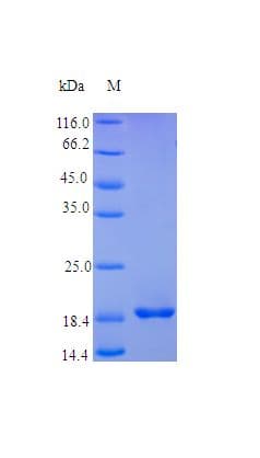 Human FGF4 Protein (Recombinant)