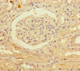 Polyclonal Rabbit anti-Human PNPLA1 Antibody