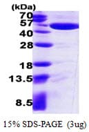 Human IDH1 / IDH Protein (Recombinant His)