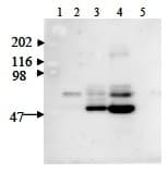 Polyclonal Rabbit anti-Human NAMPT / Visfatin Antibody (WB)