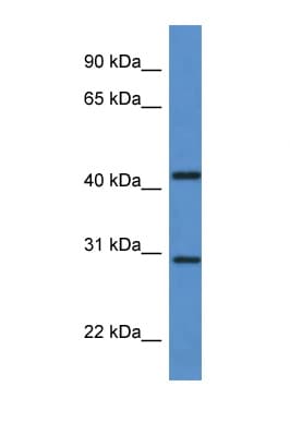 Polyclonal Rabbit anti-Human ACER1 / ASAH3 Antibody (C-Terminus, WB)