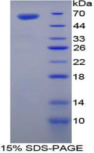 Mouse TGM1 / Transglutaminase Protein (Recombinant His-GST)
